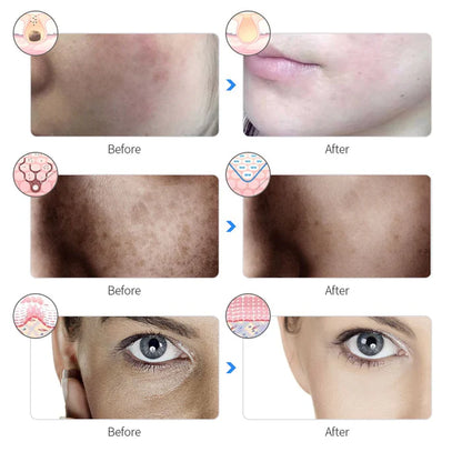 👉SAVE 50% TODAY🔥  Rechargeable Facial LED Mask 7 Colors LED Photon Therapy Beauty Mask Skin Rejuvenation Home Face Lifting Whitening Beauty Device