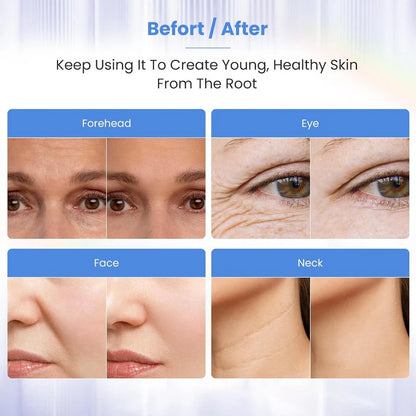 ☀️Summer Hot Sale 49% OFF🔥  Mini Micro Current EMS Beauty Instrument